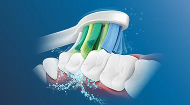 Philips Sonicare Стандартна глава i InterCare технологията Sonicare за високоскоростни вибрации четката за зъби, които превръщат пастата за зъби и водата в почистващи мехурчета